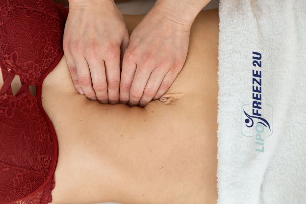 diastasis recti treatment Ealing