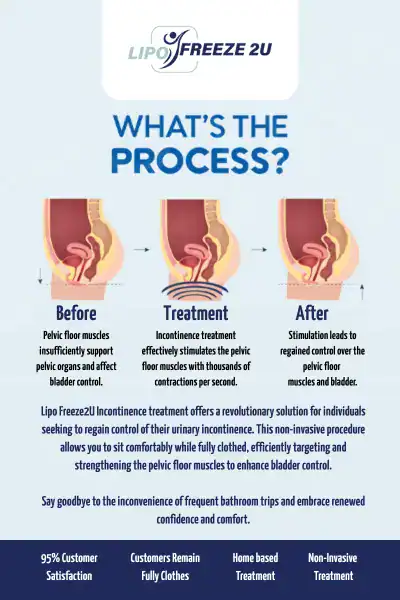 Diagram of how incontinence treatment Ealing works.
