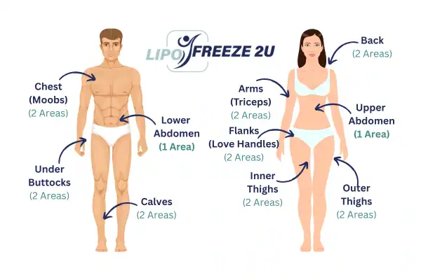 Areas you can have fat freezing treatment Ealing