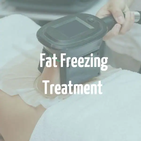 fat freezing treatment Ealing