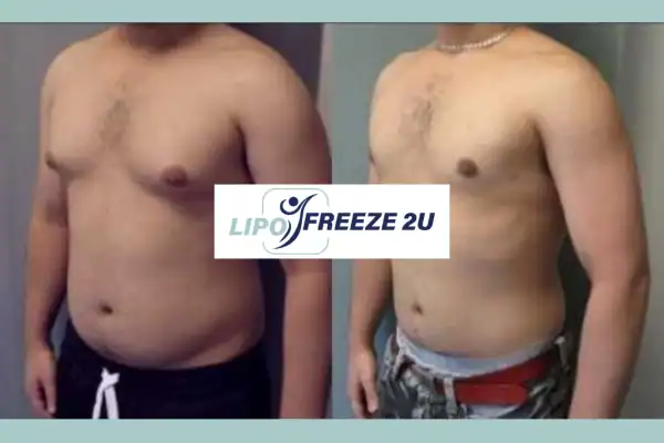How Long Does It Take to See Results Ealing?
