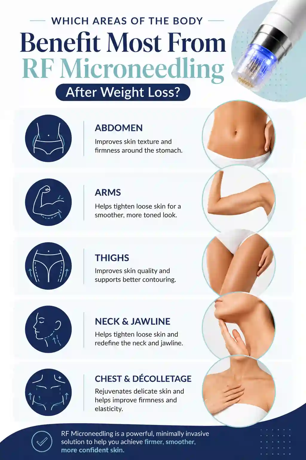 Which Areas of the Body Benefit Most From RF Microneedling After Weight Loss Ealing